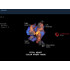 Ультразвуковая диагностическая система Philips HD11 XE
