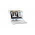 Цифровой рентгенографический аппарат Philips DuraDiagnost