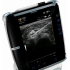 Переносной ультразвуковой (УЗИ) сканер Venue 40