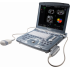 Диагностический ультразвуковой сканер Voluson