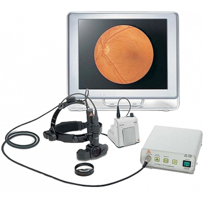 Видеоофтальмоскоп для видеотерапии Omega 2C Heine