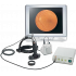 Видеоофтальмоскоп для видеотерапии Omega 2C Heine