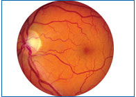 retina