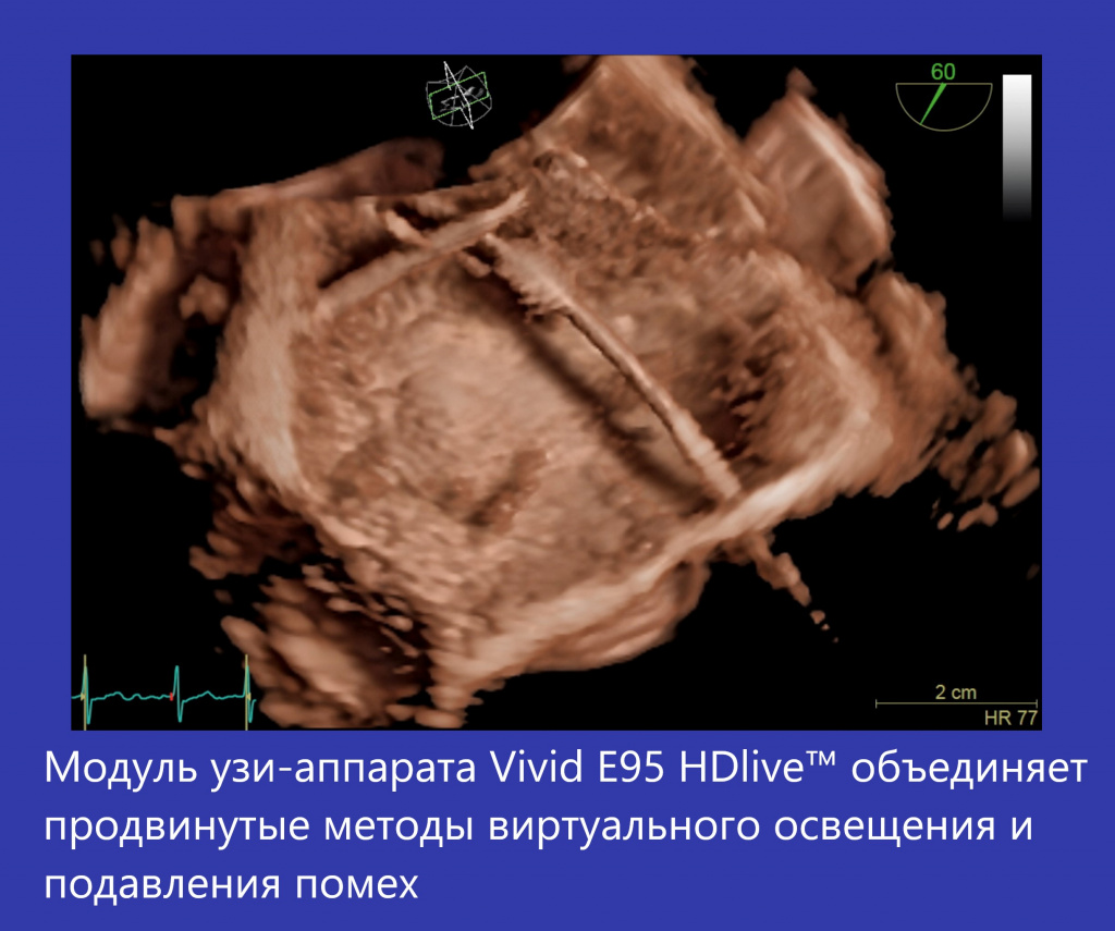 Vivid E95-1.jpg
