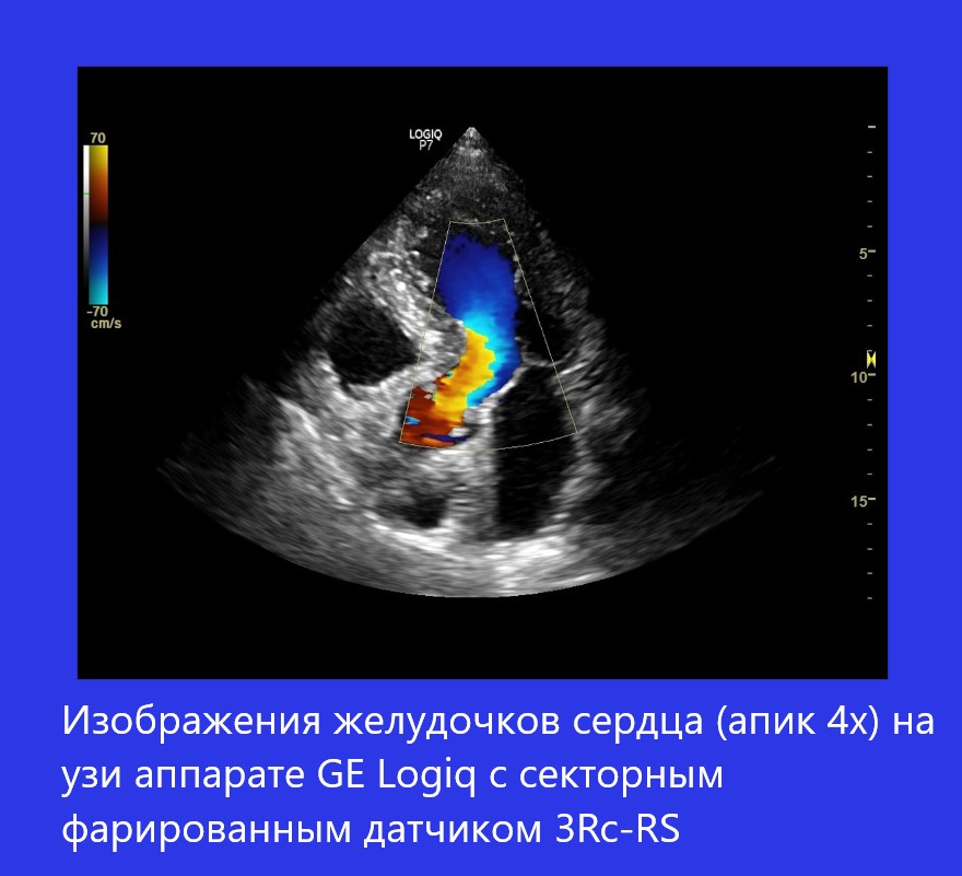 logiq_p7_1.jpg