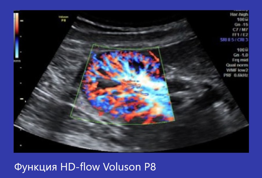 Voluson P8-2.jpg Voluson P8-2.jpg