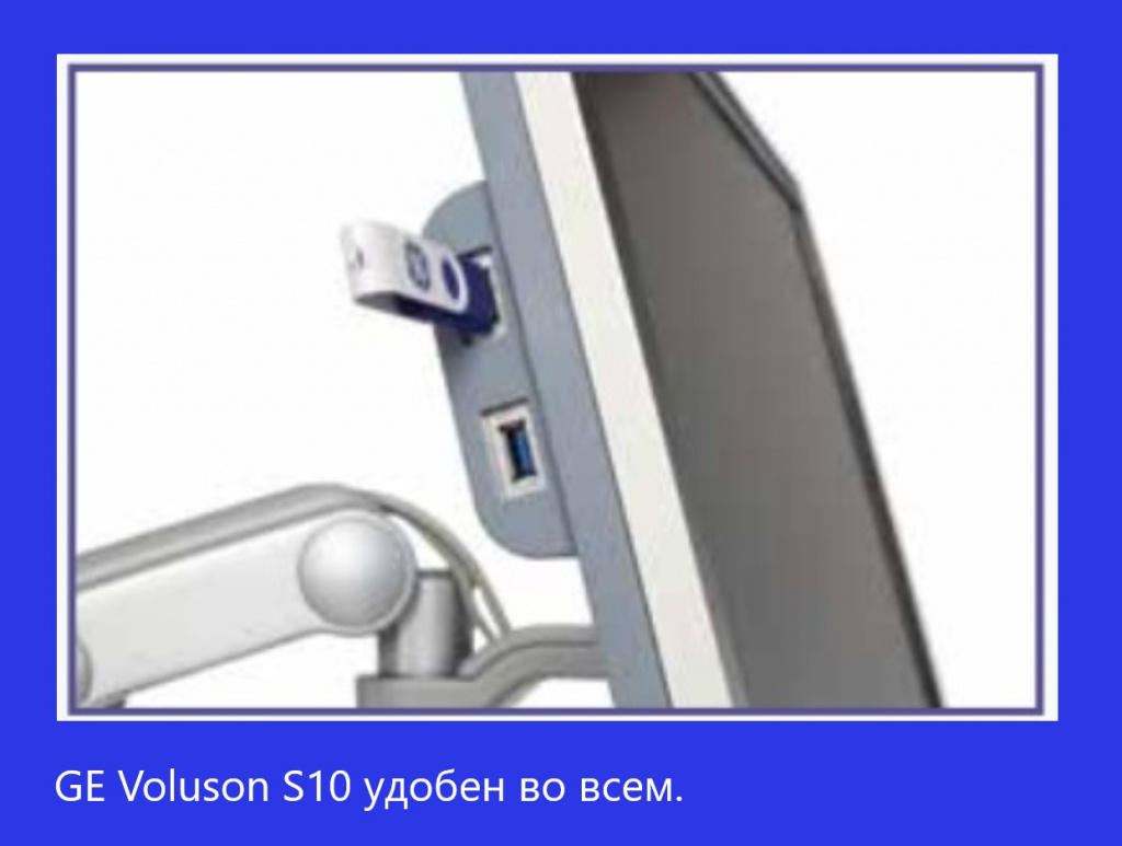 Voluson S10-2.jpg