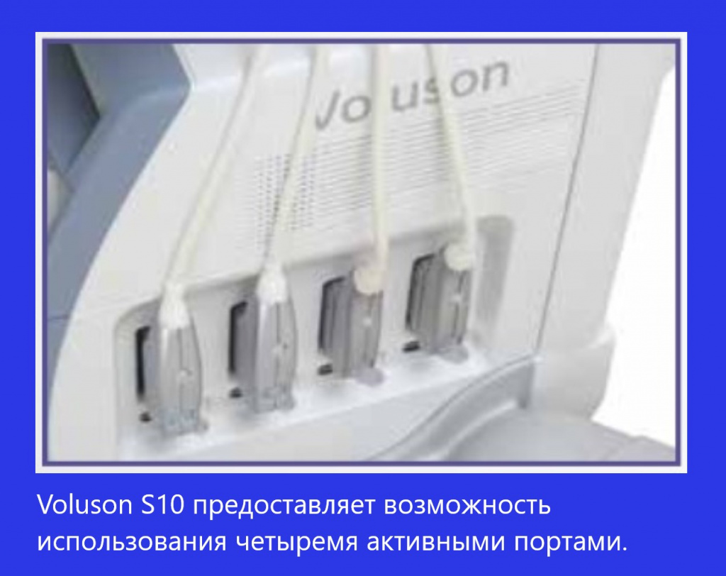 Voluson S10-3.jpg