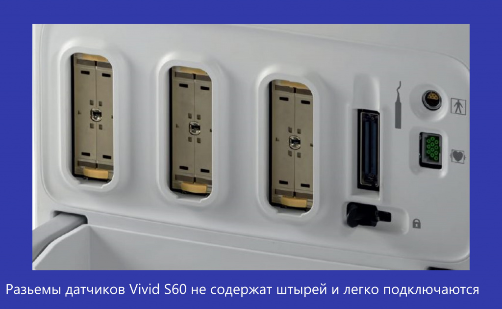Vivid S60-1.jpg